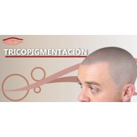Tricopigmentación